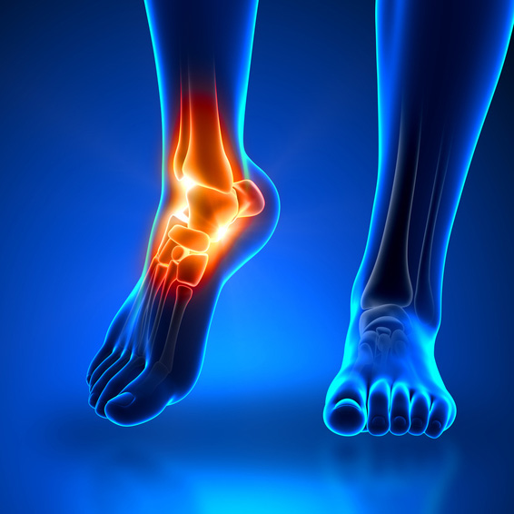 Ankle Pain