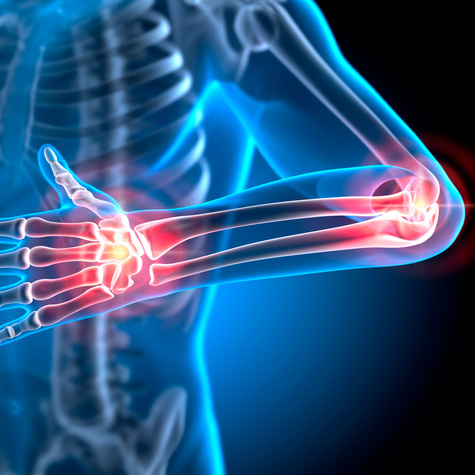 Elbow and Wrist Pain