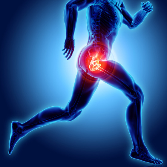 Hip Pain